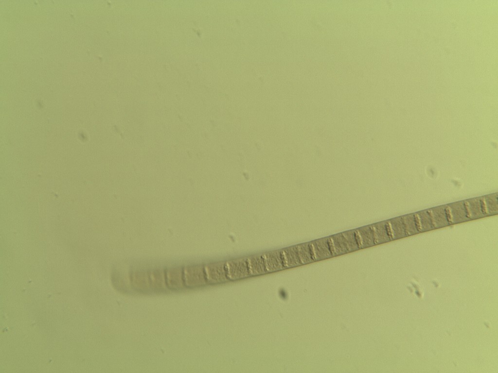 Cianoficea
